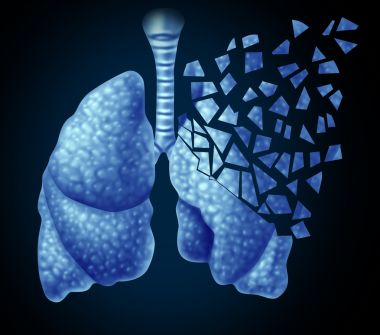 二十五味肺病丸的作用及治什么病？