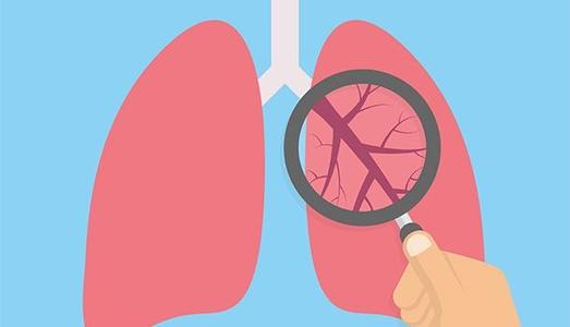 二十五味肺病胶囊可以治疗气喘吗